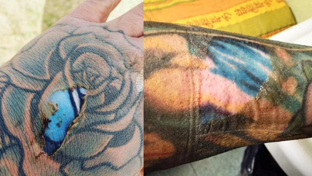 How Long is the Peeling Phase of a Tattoo: Expert Insights